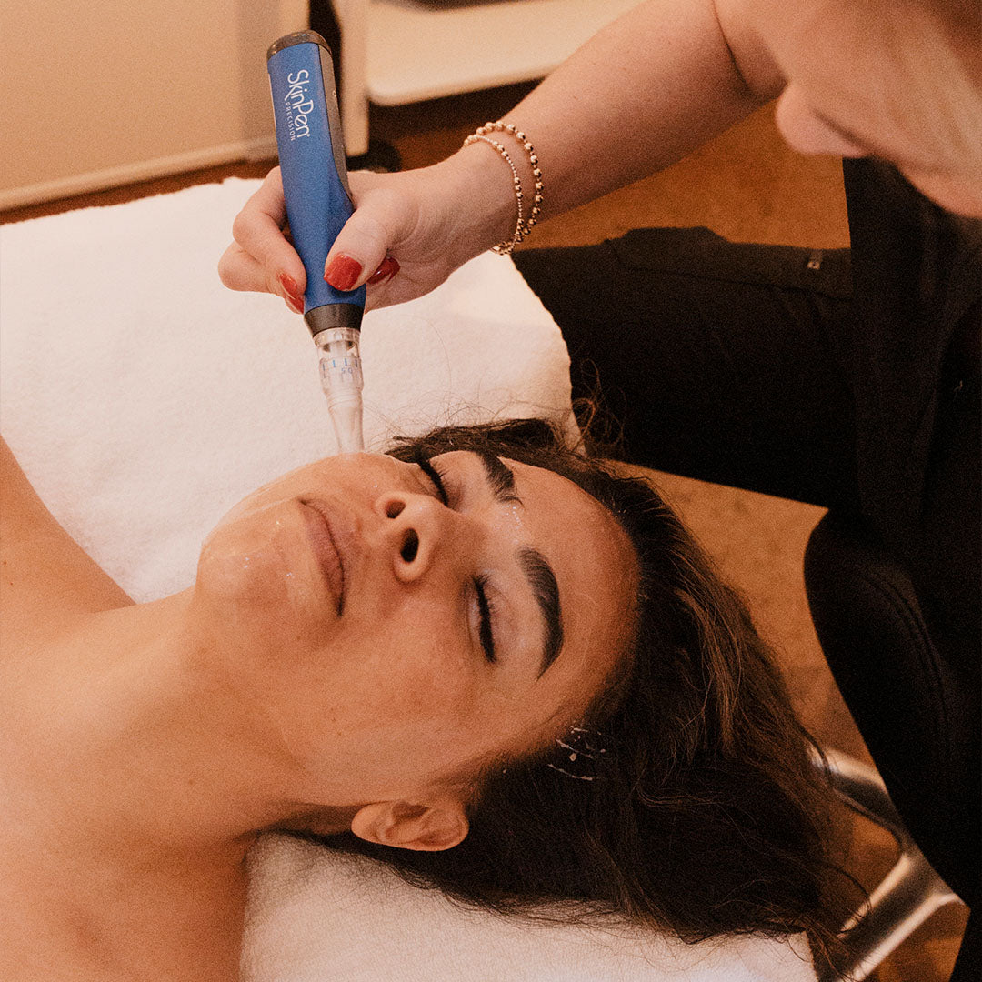 patient receiving skinpen microneedling facial treatment